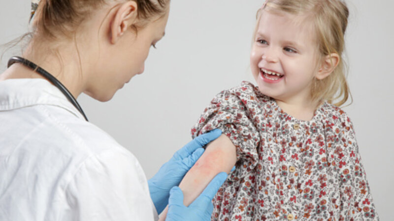 Allergies alimentaires : les comprendre pour mieux les traiter