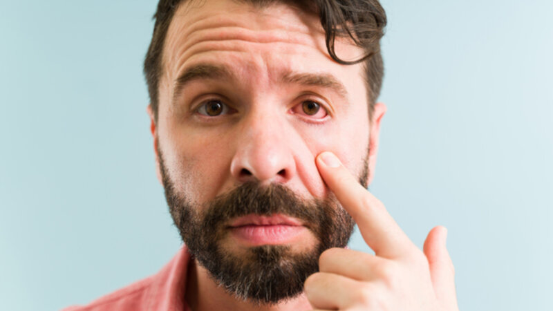 Comment prendre en charge une conjonctivite ?