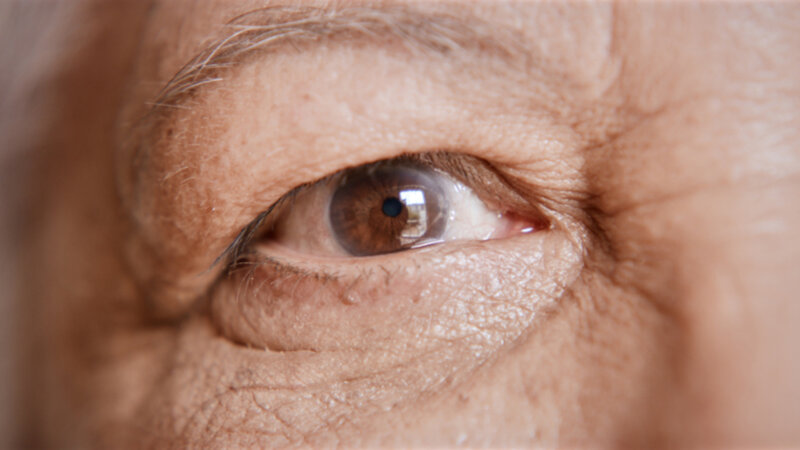 Qu’est-ce que le glaucome ?