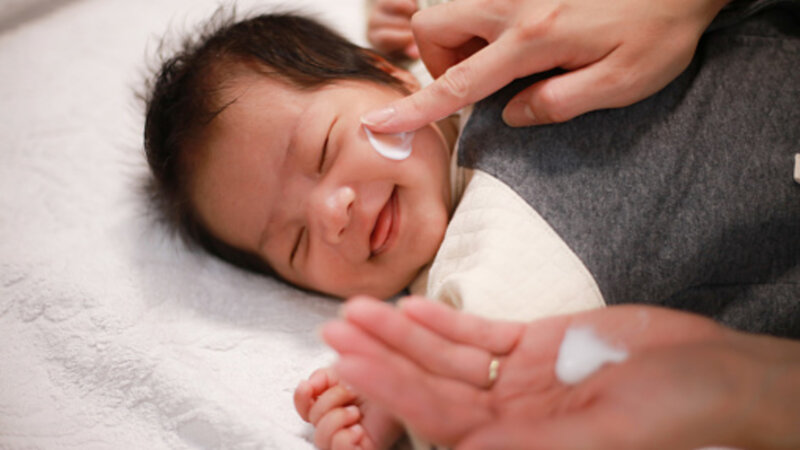 Dermatite atopique :  comment soulager bébé ?