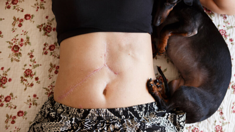 Altérations de la peau et cicatrices