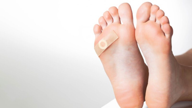 Les verrues, cela se traite