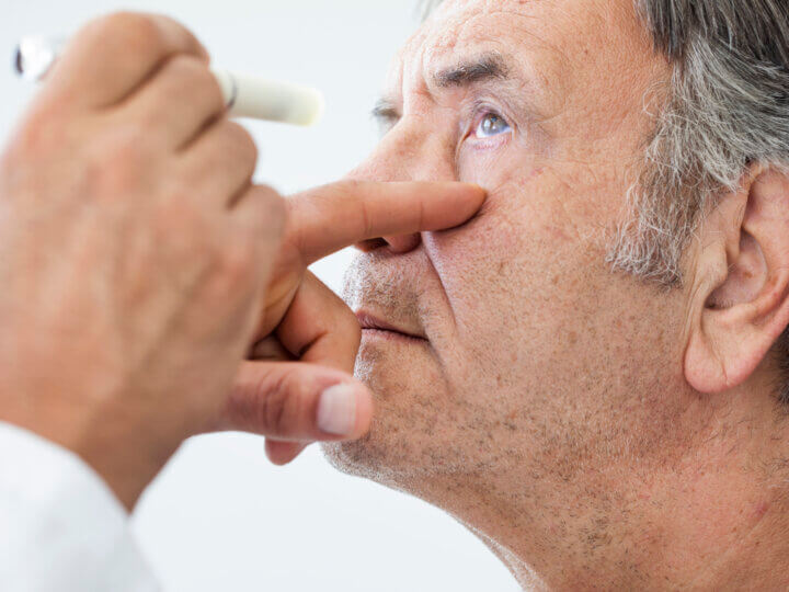 Qu’est-ce que la cataracte ?