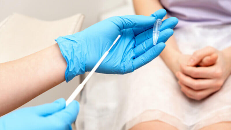 Comment prévenir les IST ?