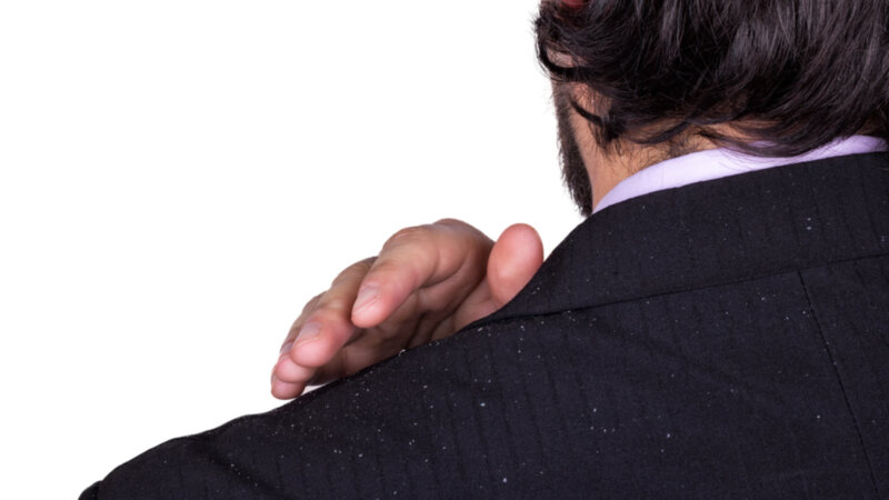 Les pellicules : comment en venir à bout ?