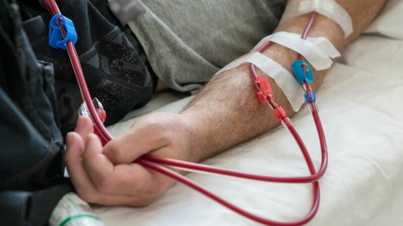 Insuffisance rénale : quand une dialyse est-elle nécessaire ?