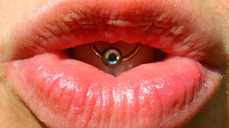 Piercing « smiley », entre esthétique et santé bucco-dentaire, il faut choisir