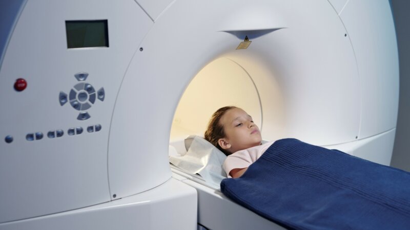 Le médulloblastome, la tumeur cérébrale la plus fréquente chez l’enfant