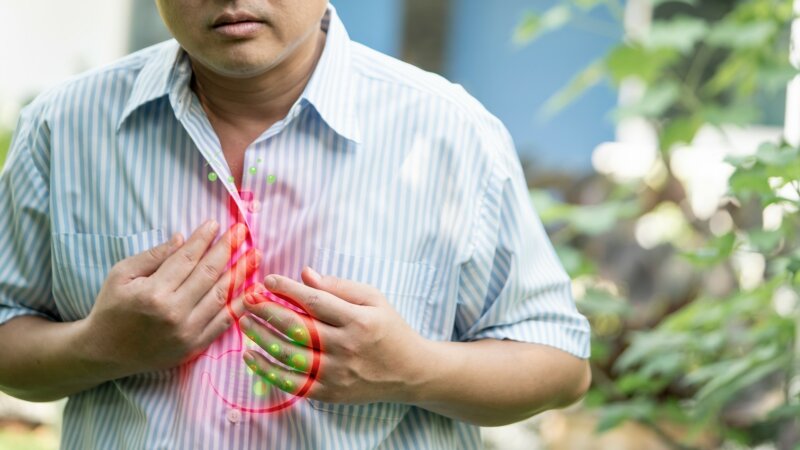 Quelles sont les causes du reflux gastro-œsophagien ?