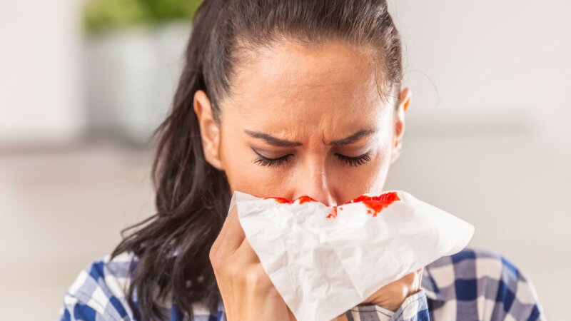 Epistaxis : pourquoi certains saignent souvent du nez ?