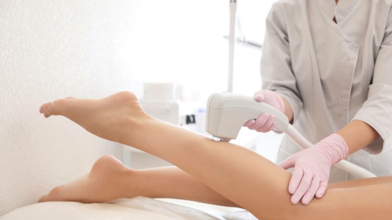 Epilation définitive : les esthéticiennes autorisées à utiliser la lumière pulsée