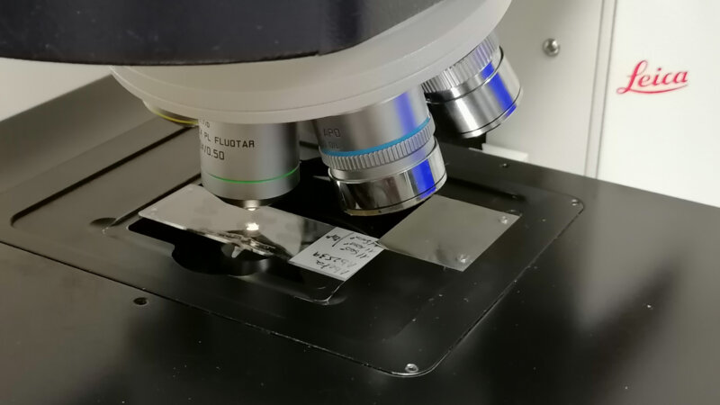 Alzheimer : une découverte qui protège le cerveau de la maladie