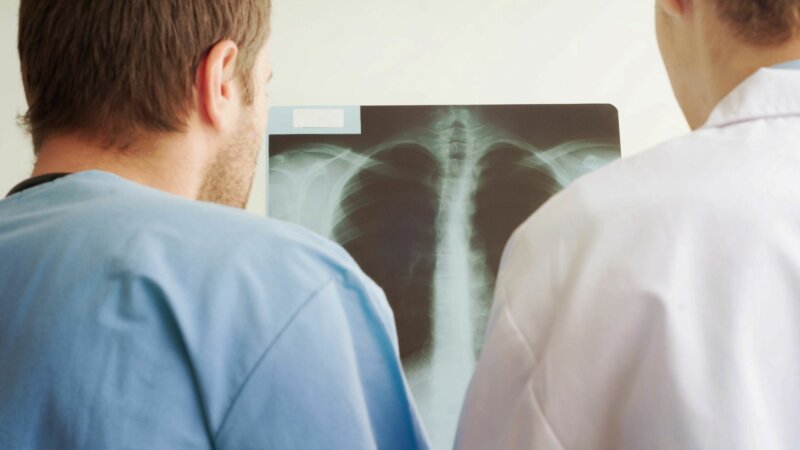 Les cas de cancers chez les hommes pourraient doubler d’ici 2050