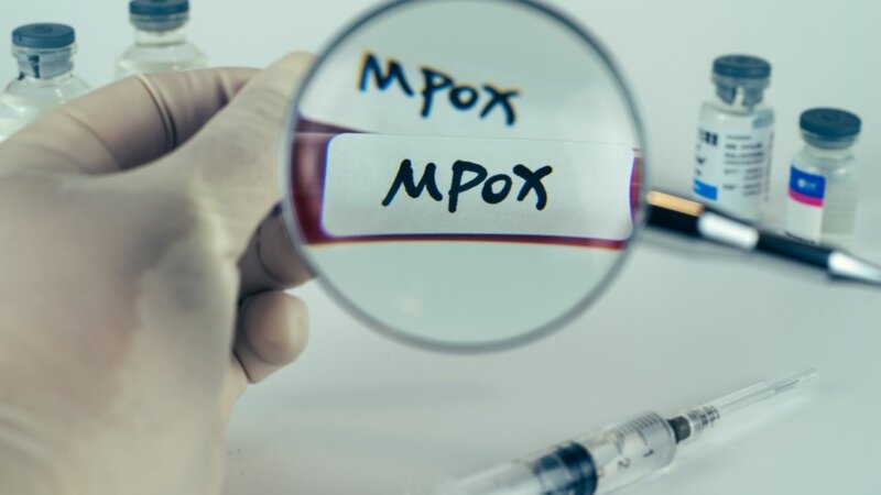 Mpox : 4 choses à savoir sur la variole du singe