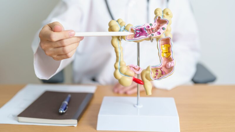 Cancer : comment l’inflammation chronique peut provoquer la maladie