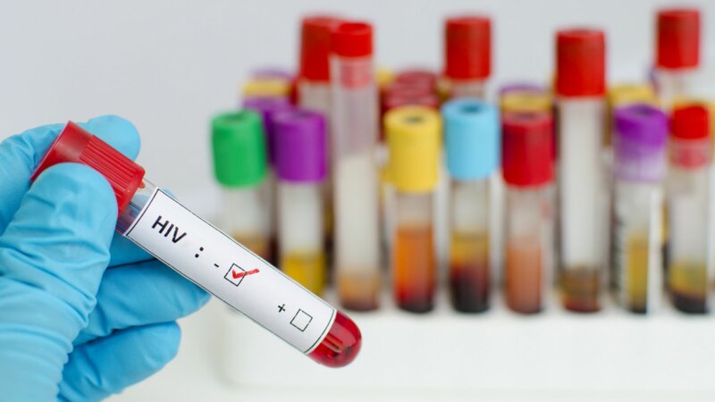 Rémission du VIH : le cas unique d’un patient de Genève