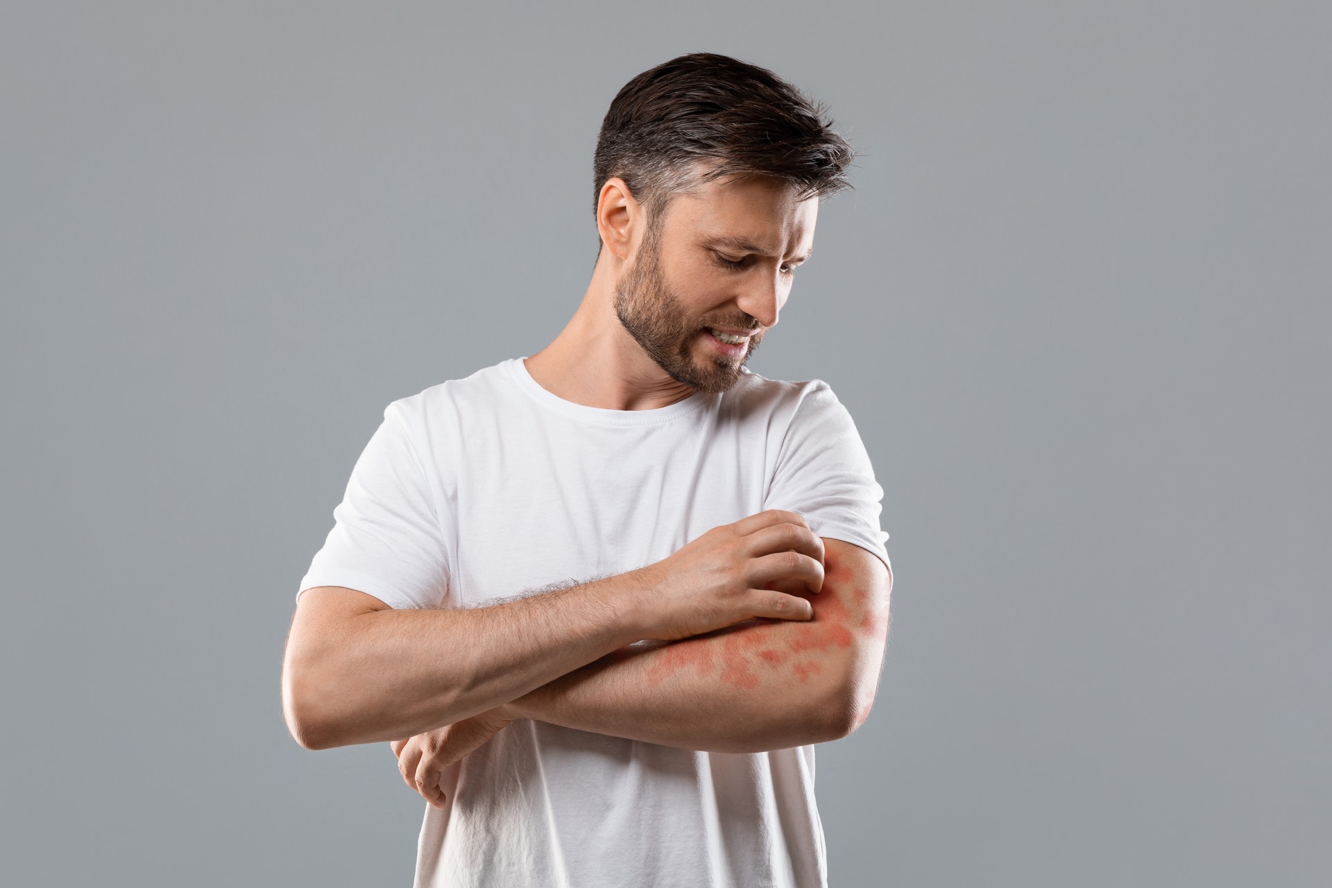 Une nouvelle piste prometteuse dans le traitement du psoriasis