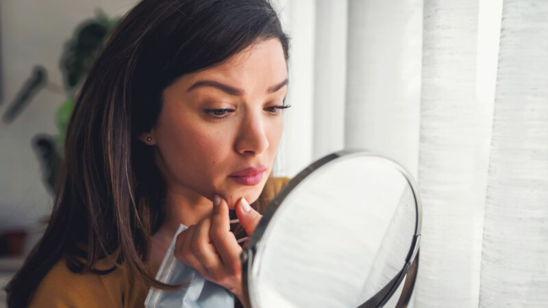 Acné de l’adulte : des causes multiples