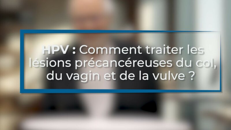 HPV : comment traiter les lésions précancéreuses ? (Vidéo)