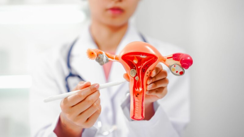 Cancer de l’ovaire : ces trois symptômes qui doivent alerter