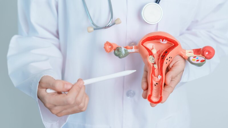 Cancer de l’endomètre : 7 choses à savoir