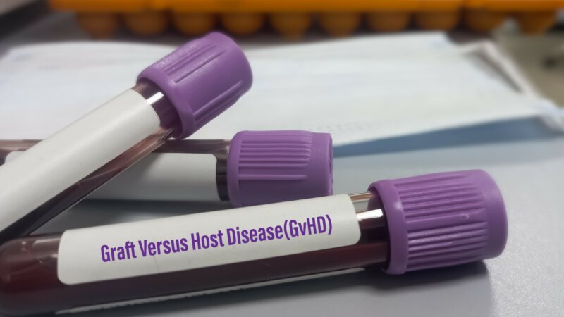 Décès de Laurent Tirard : qu’est-ce que la maladie greffon contre hôte ?