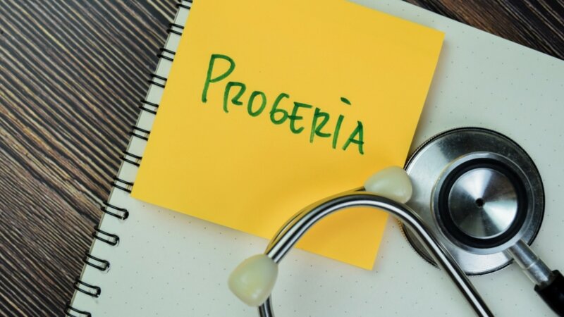 Vieillissement prématuré : qu’est-ce que la progéria ?