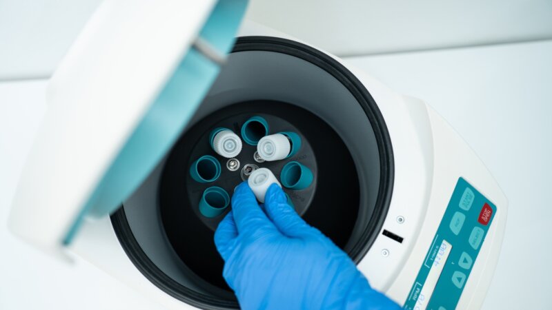 Don de sperme : qui sont les donneurs ?