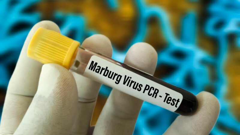 Epidémie de virus Marburg au Rwanda : qu’est-ce que cette fièvre hémorragique ?