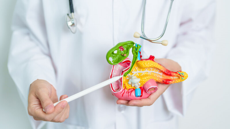 Cancer du pancréas : ces 10 signes qui doivent alerter