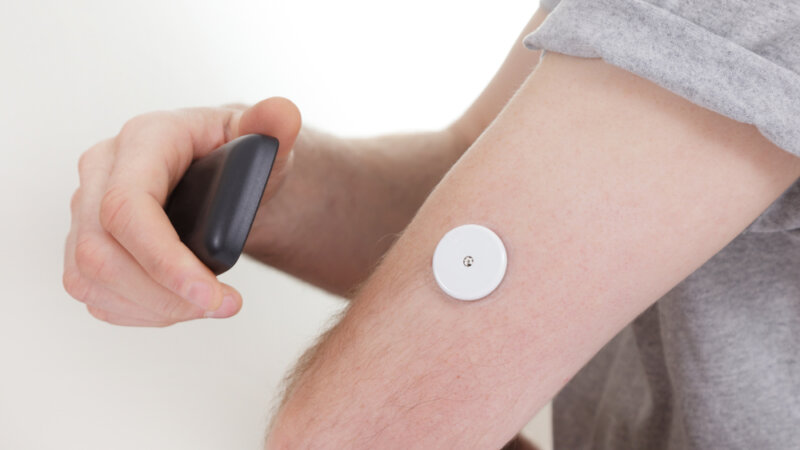 Diabète : comment la mesure en continu du glucose a changé la vie des patients