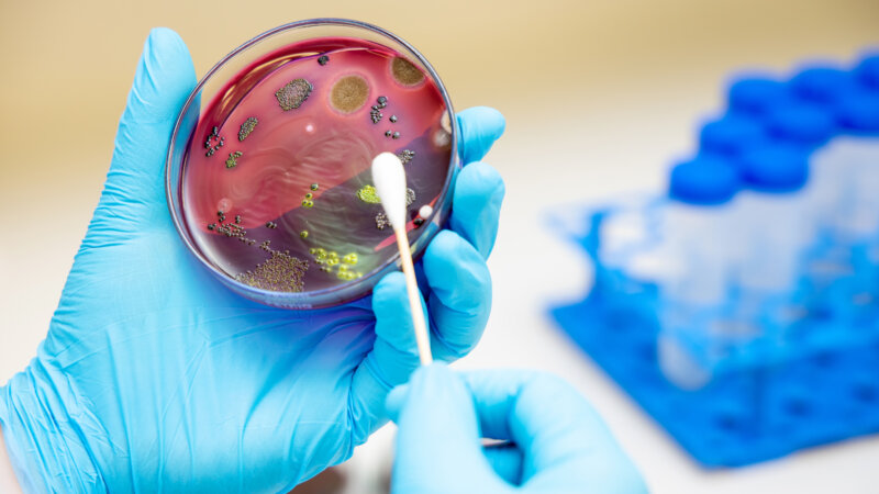 Comment les bactéries deviennent-elles résistantes aux antibiotiques ?