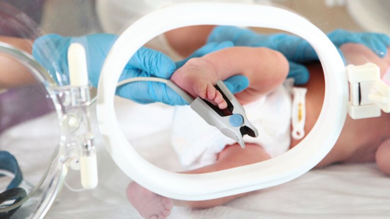 Paralysie cérébrale : la diagnostiquer plus tôt pour diminuer les troubles chez l’enfant