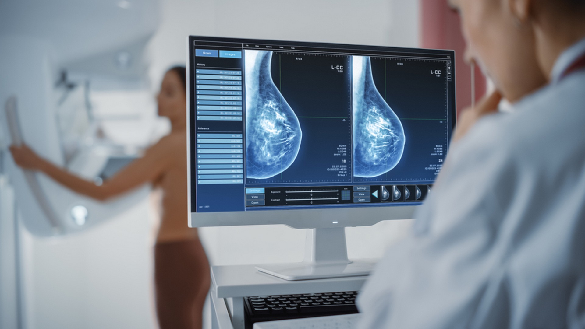 L’intelligence artificielle pourrait révolutionner le dépistage du cancer du sein
