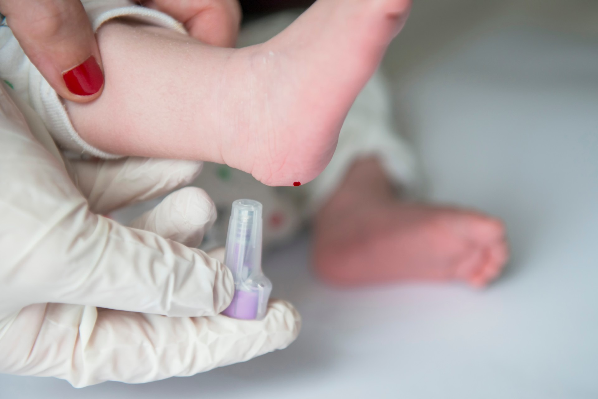 Maladies rares : 6 questions pour mieux comprendre
