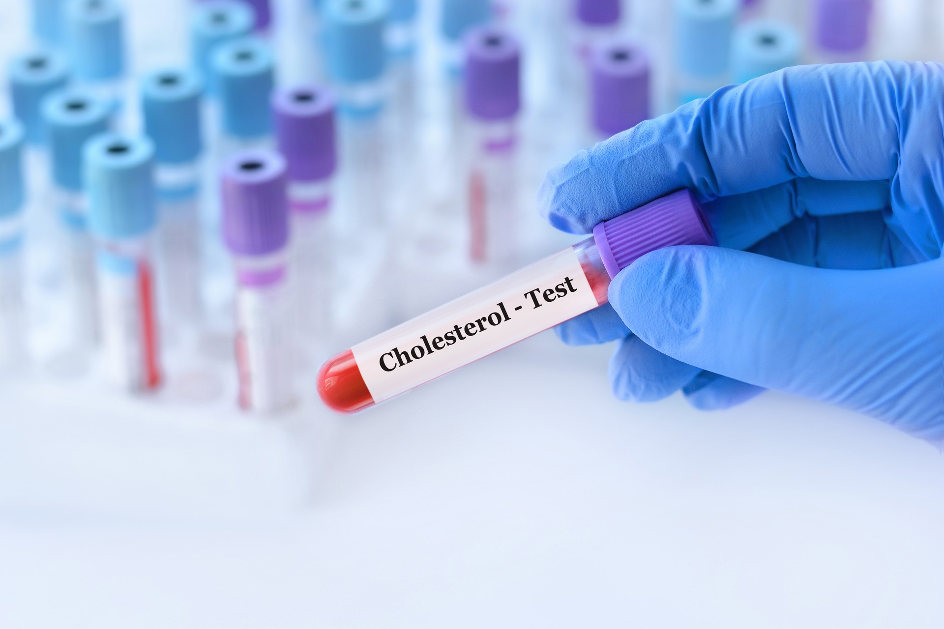 A 40 ans, faites le point sur votre cholestérol !
