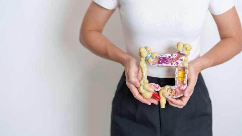 Cancer colorectal : combien lui faut-il de temps pour se développer ?