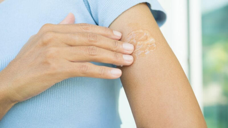 Comment atténuer mes cicatrices ?