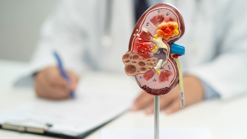 Journée internationale du rein : connaissez-vous vos reins ?