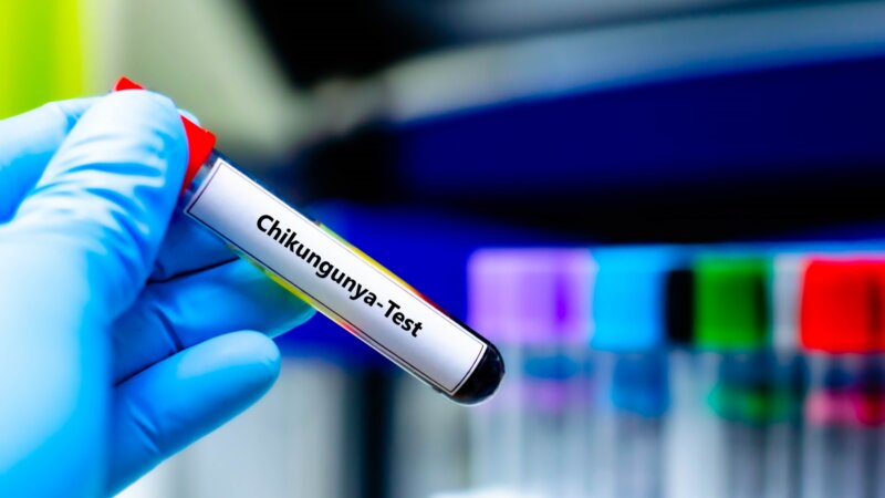 Epidémie de chikungunya à La Réunion : quels sont les symptômes ?