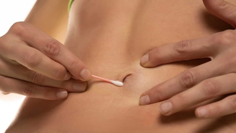 Voici ce qui peut arriver si vous ne nettoyez pas votre nombril