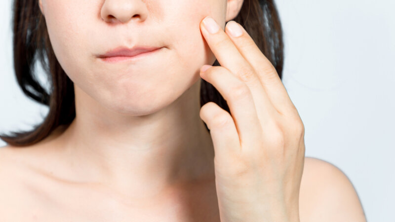 Pourquoi j’ai souvent des aphtes…