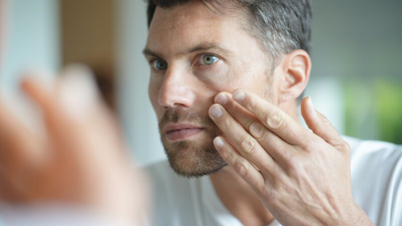 Diabète : pourquoi la qualité de la peau est-elle altérée ?