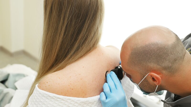 Mélanome et carcinome : 8 bons réflexes pour prévenir un second cancer cutané