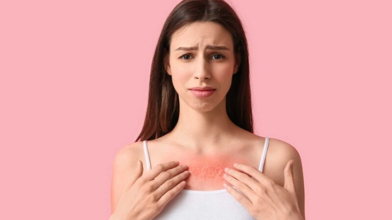 Photosensibilisation : quand soleil et médicaments ne font pas bon ménage