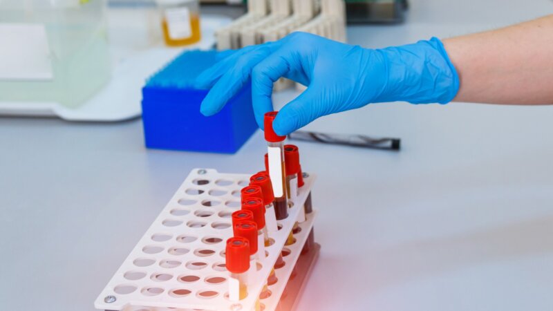 Des chercheurs français découvrent un nouveau groupe sanguin