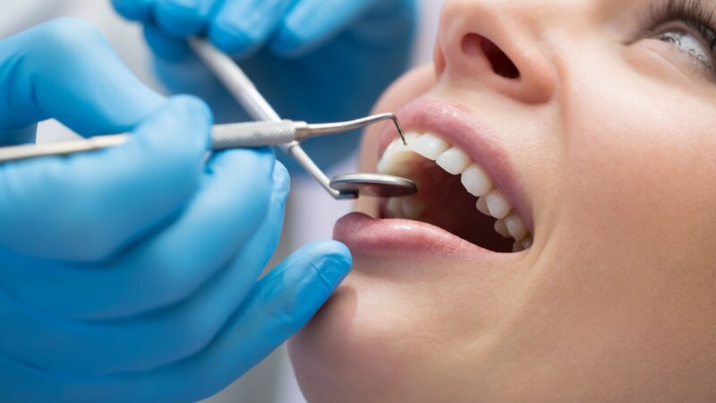 Santé bucco-dentaire : 5 idées reçues sur les dents