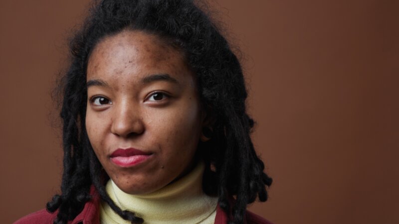 Dermatoses des peaux foncées : la nécessité d’une médecine plus inclusive  