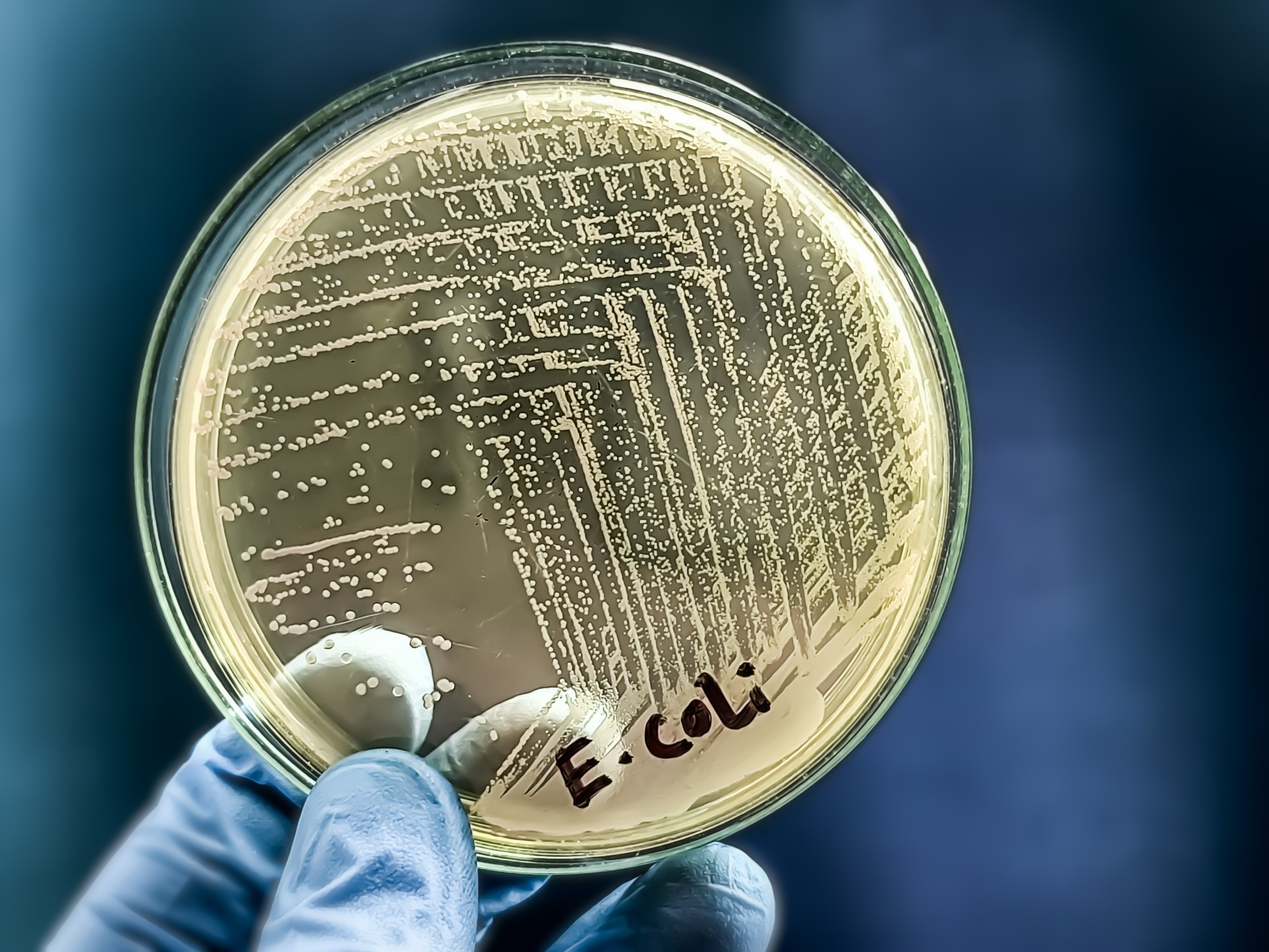 Alimentation : les infections à E. Coli et Listeria en hausse en Europe