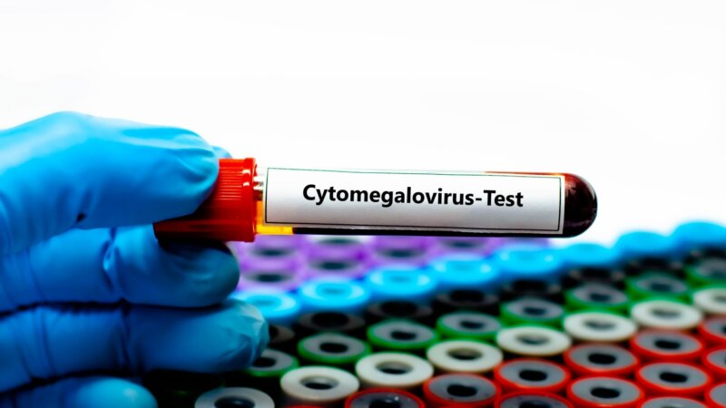 Cytomégalovirus : la HAS recommande un dépistage systématique chez les femmes enceintes